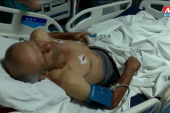 Srbin pretučen kod Zubinog Potoka u šok-sobi: Lekari rade "bodi sken“, sumnja se na unutrašnje povrede (VIDEO)