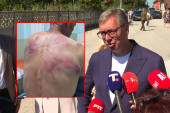 Vučić o prebijanju Srbina na KiM i licemerju Evropljana: Leđa Nenada Raškovića su lice Aljbina Kurtija