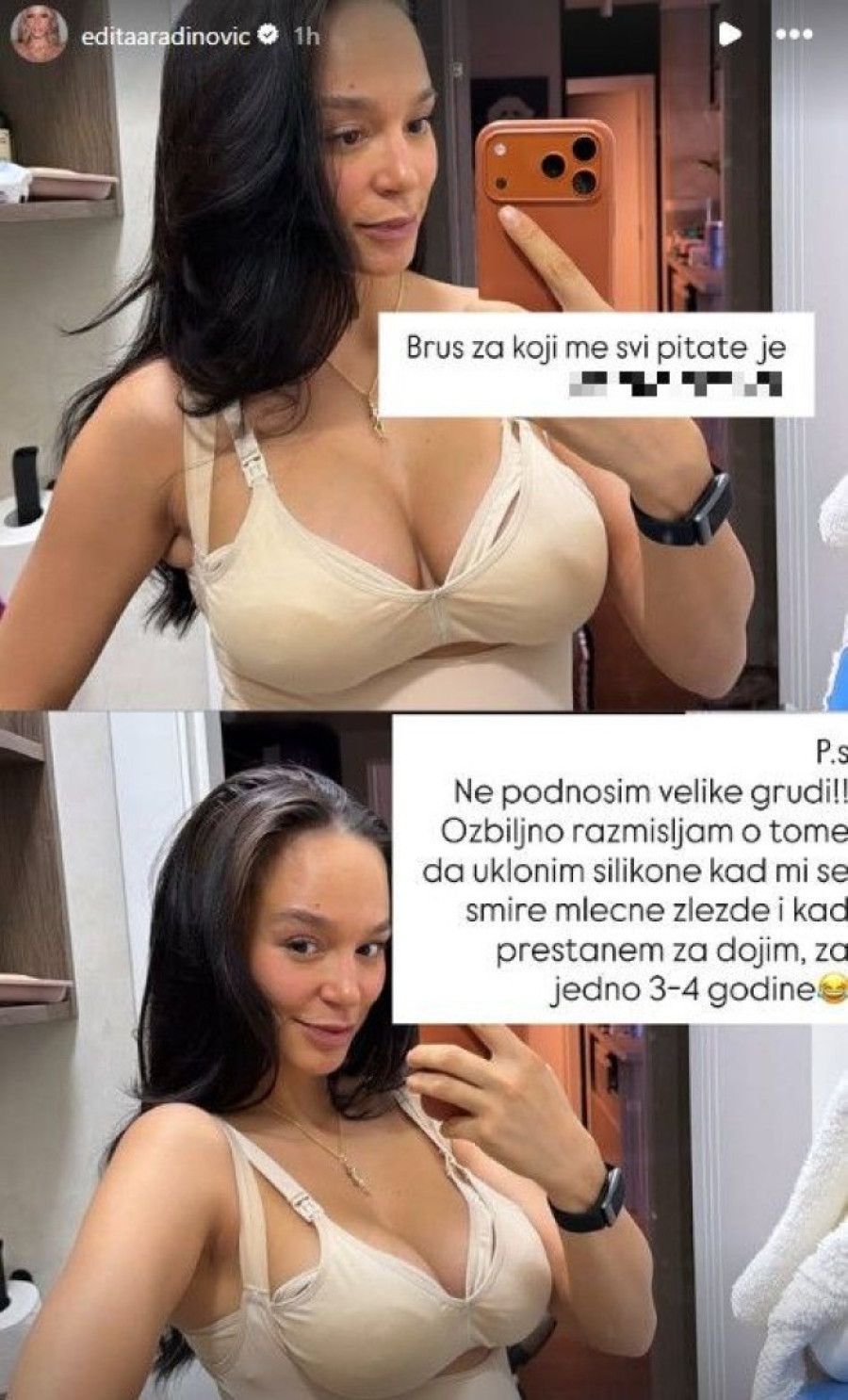 Edita planira vađenje silikona iz grudi: Evo i zašto! (FOTO)