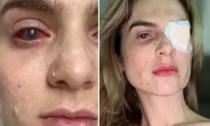 Zbog menstrualnih bolova popila ibuprofen, pa završila u komi: „Kao da sam izgorela iznutra“