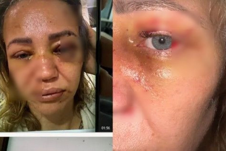 Oglasilo se tužilaštvo nakon zverski prebijene influenserke u Šapcu!