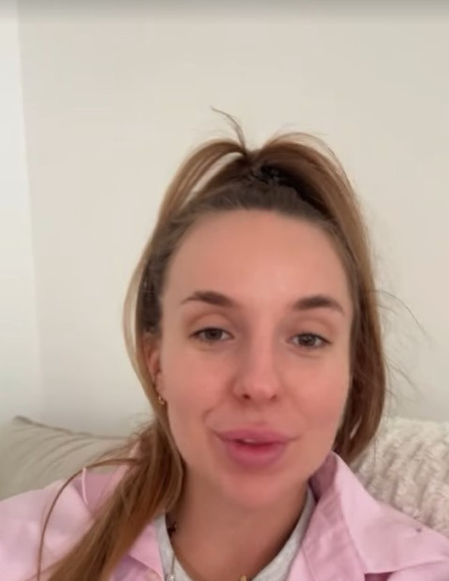 Lea Stanković topi hijaluron iz usana! Posle pet godina primetila promenu: „Svi kažu da se to dešava“