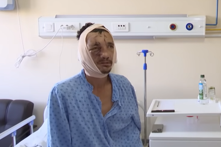 Viktora napala medvedica u šumi! Iščupala mu vilicu, smrskala nos, polomila rebra i ruku... - pukom srećom preživeo! (VIDEO)